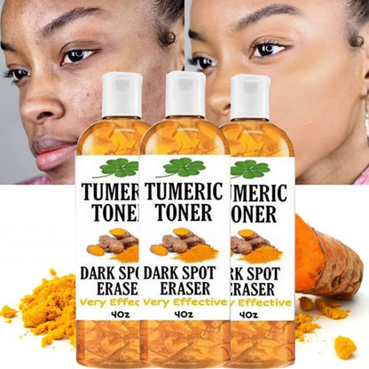 Tonique Visage au Curcuma – Éclat, Taches et Rides