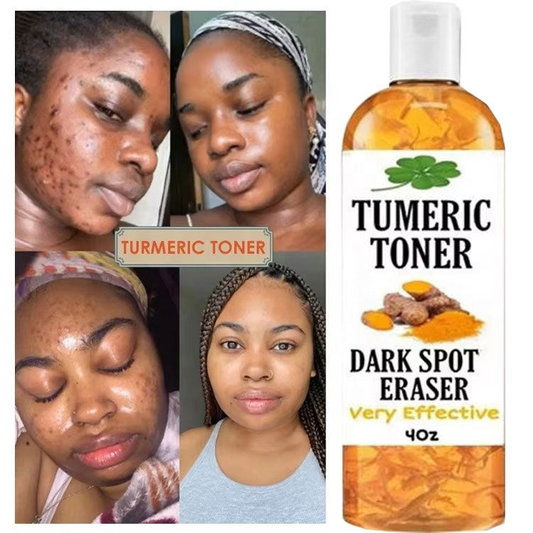 Tonique Visage au Curcuma – Éclat, Taches et Rides